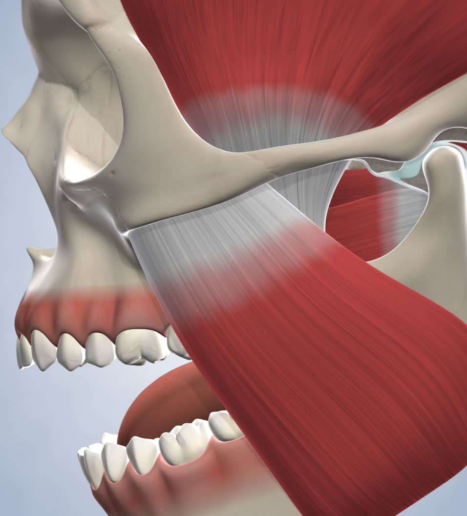 A jaw with TMJ.